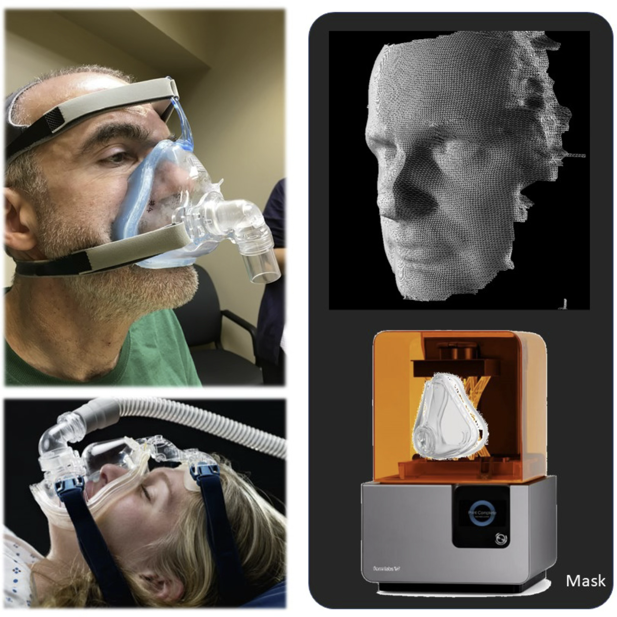 Mask - Mass Customization of Masks for ALS and Sleep-Disorder Patients