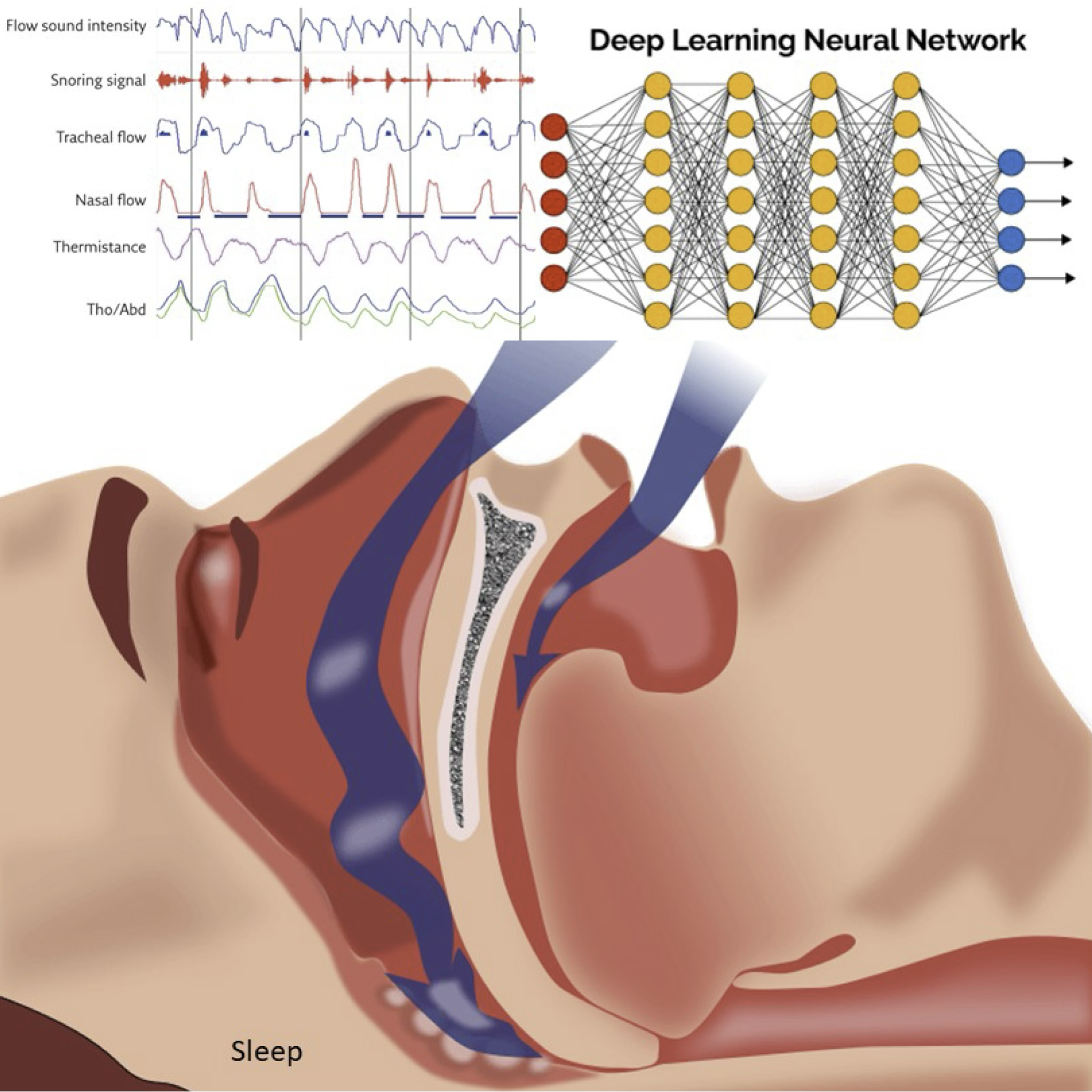 Sleep - Machine Learning-Based Sleep Monitoring and Diagnosis