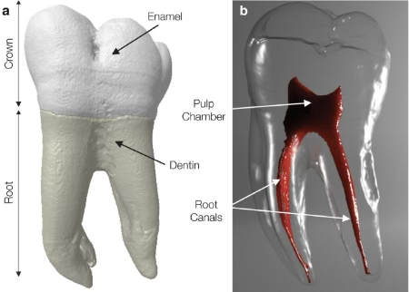Super Resolution - CBCT Image Enhancement with μCT Ground Truth