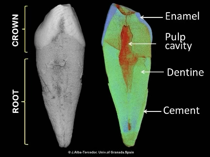 Super Resolution - CBCT Image Enhancement with μCT Ground Truth