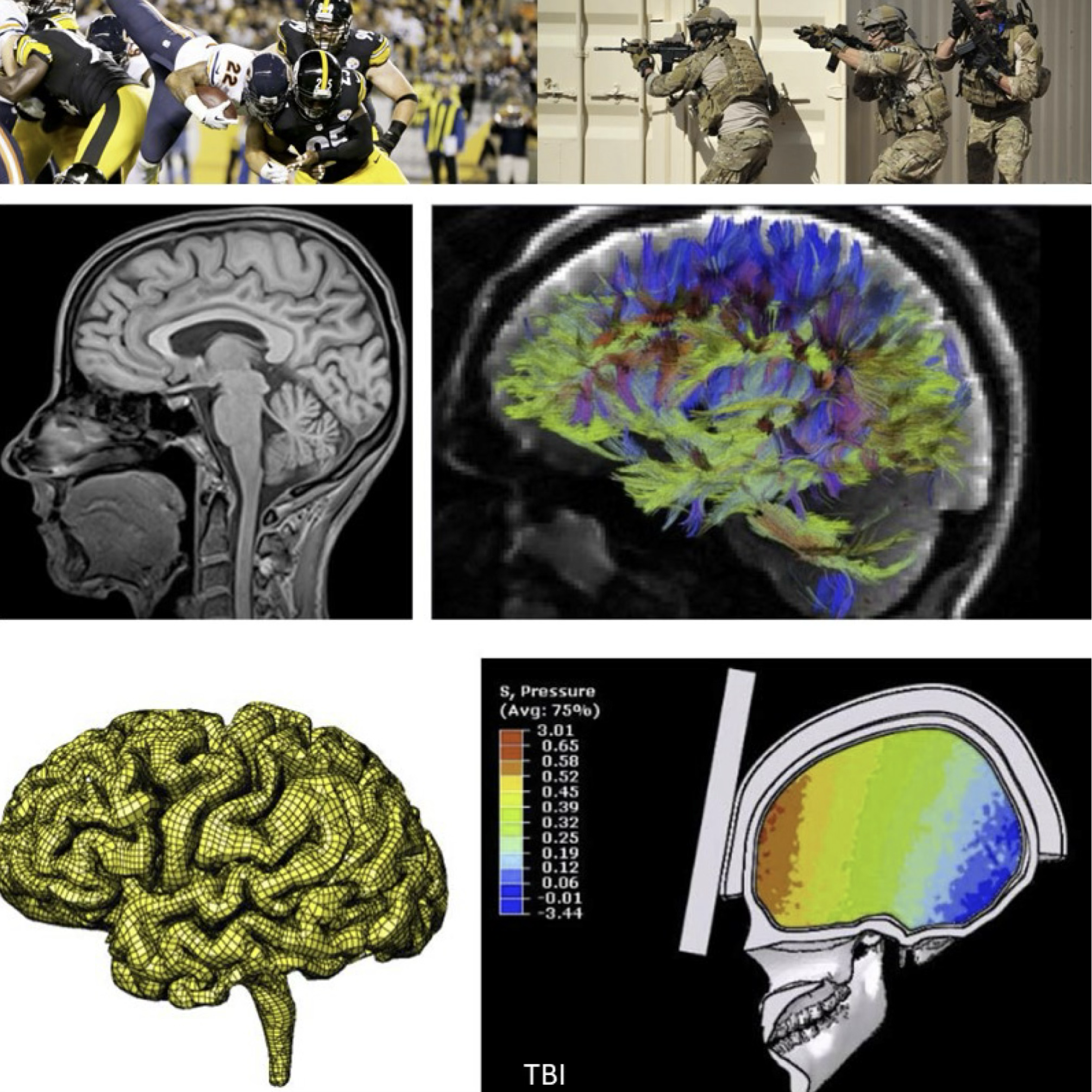 TBI - Computational Simulation of Traumatic Brain Injury