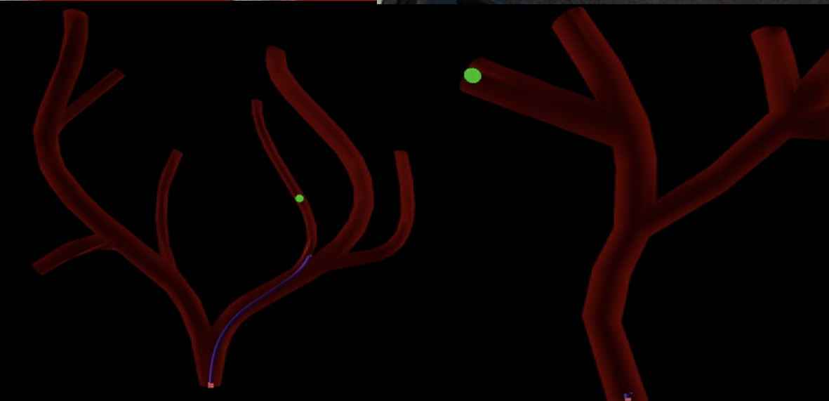 Telesurgery - Teleoperated Endovascular Surgical Robot